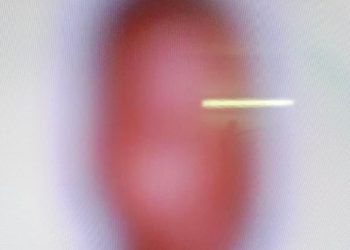 Le présumé meurtrier de l’artiste Coupé-décalé Vicky Martini arrêté