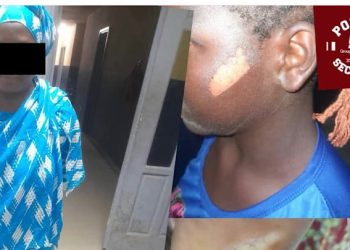 Aïcha, une fillette de 12 ans brûlée au couteau chaud le 19 juin 2025 par sa tante