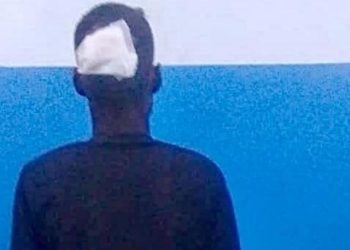 Un homme, armé de plusieurs couteaux, a mortellement agressé son frère